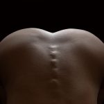 Onko anaaliseksi kivuliasta